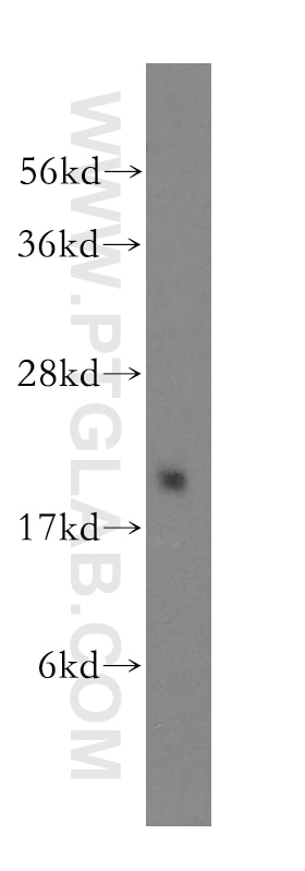 WB analysis of HeLa using 12307-2-AP