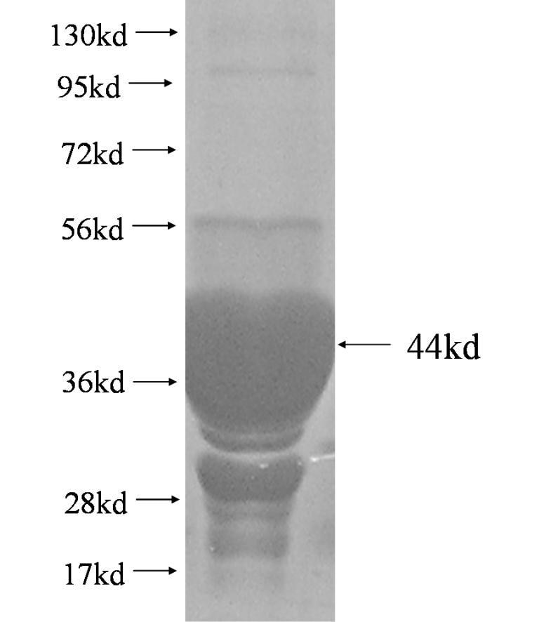 GEMIN6 fusion protein Ag2954 SDS-PAGE