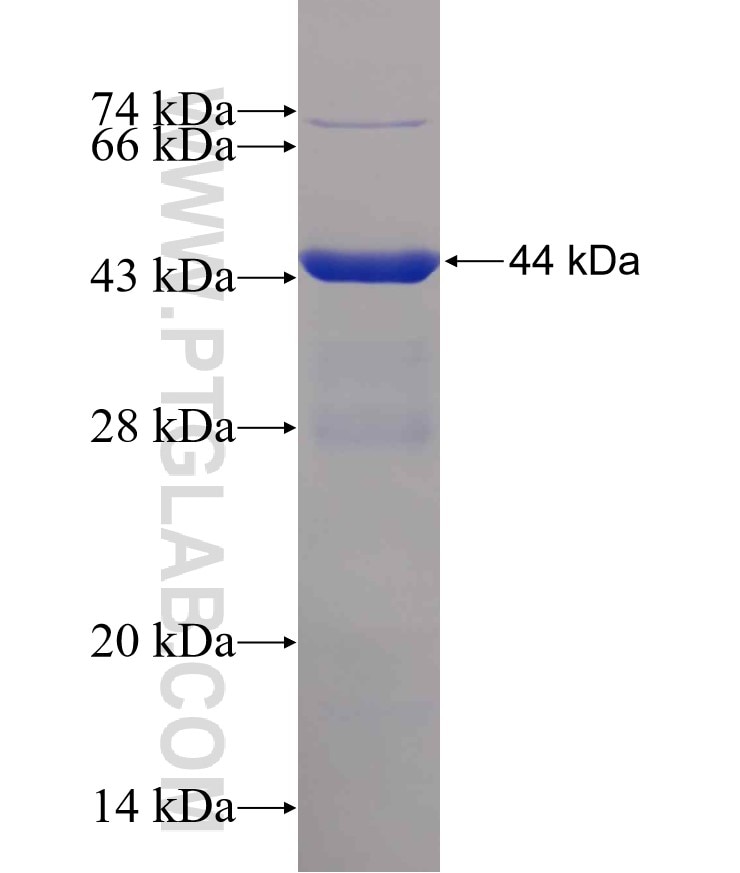 GEMIN7 fusion protein Ag0976 SDS-PAGE