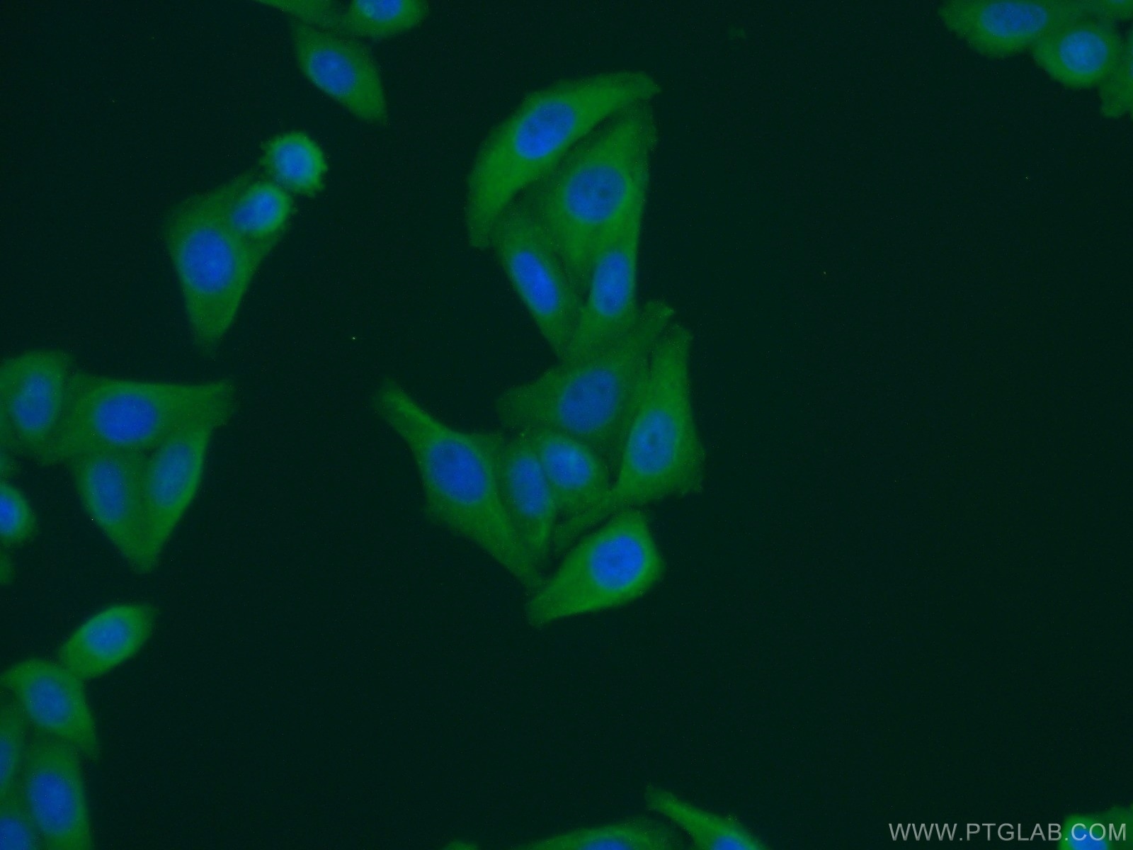 Immunofluorescence (IF) / fluorescent staining of HepG2 cells using GEMIN8 Polyclonal antibody (15251-1-AP)