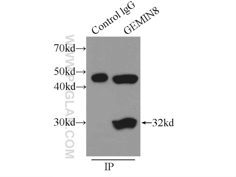 Immunoprecipitation (IP) experiment of HepG2 cells using GEMIN8 Polyclonal antibody (15251-1-AP)