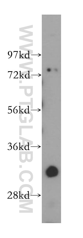 Western Blot (WB) analysis of HepG2 cells using GEMIN8 Polyclonal antibody (15251-1-AP)