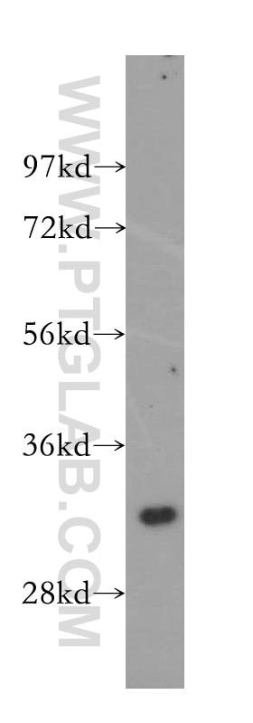Western Blot (WB) analysis of HEK-293 cells using GEMIN8 Polyclonal antibody (15251-1-AP)