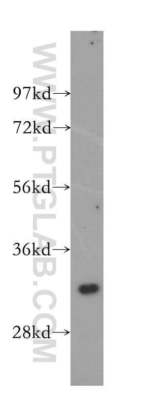 WB analysis of HEK-293 using 15251-1-AP