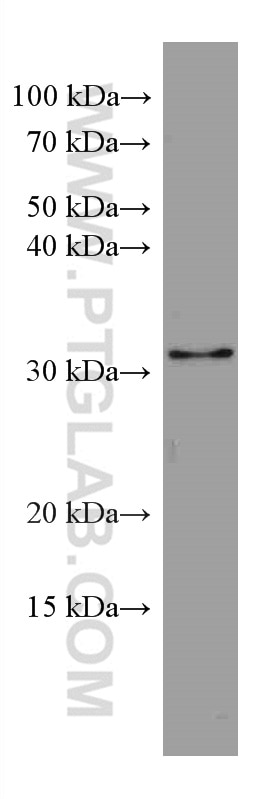 Western Blot (WB) analysis of HeLa cells using GEMIN8 Monoclonal antibody (67871-1-Ig)