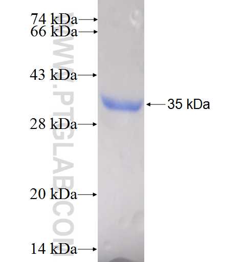 GEMIN8 fusion protein Ag6774 SDS-PAGE