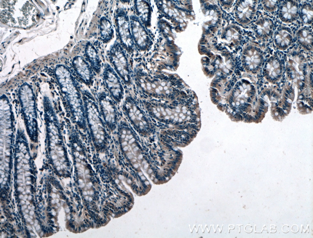 Immunohistochemistry (IHC) staining of human colon tissue using GET4 Polyclonal antibody (27768-1-AP)