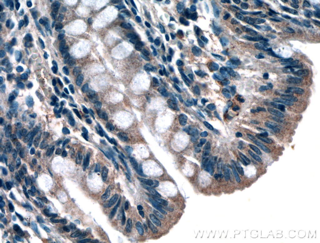 Immunohistochemistry (IHC) staining of human colon tissue using GET4 Polyclonal antibody (27768-1-AP)