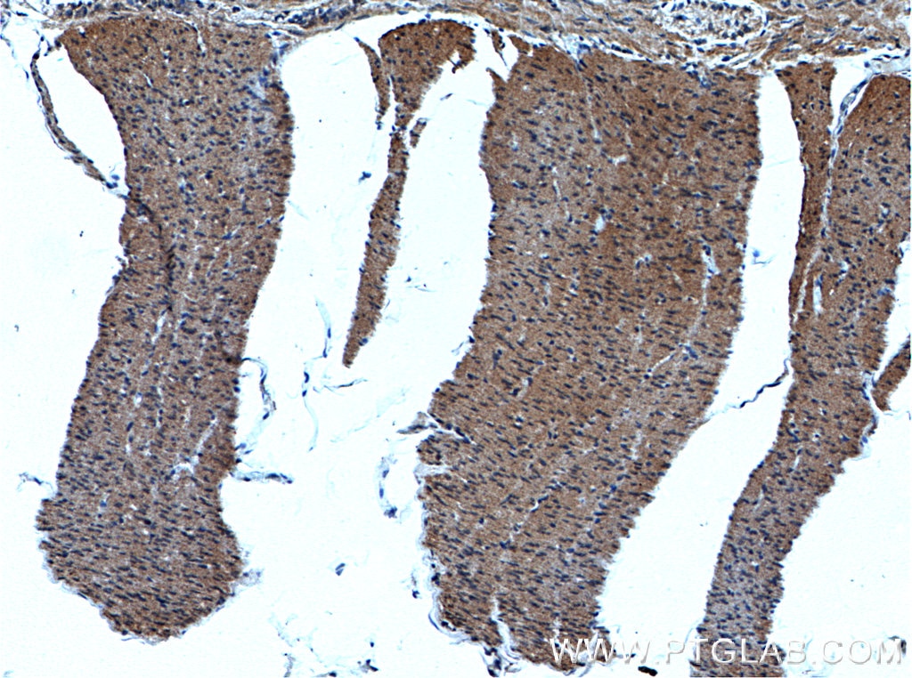 Immunohistochemistry (IHC) staining of human colon tissue using GET4 Polyclonal antibody (27768-1-AP)