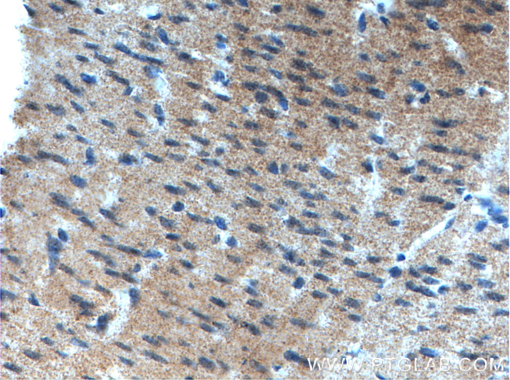 Immunohistochemistry (IHC) staining of human colon tissue using GET4 Polyclonal antibody (27768-1-AP)
