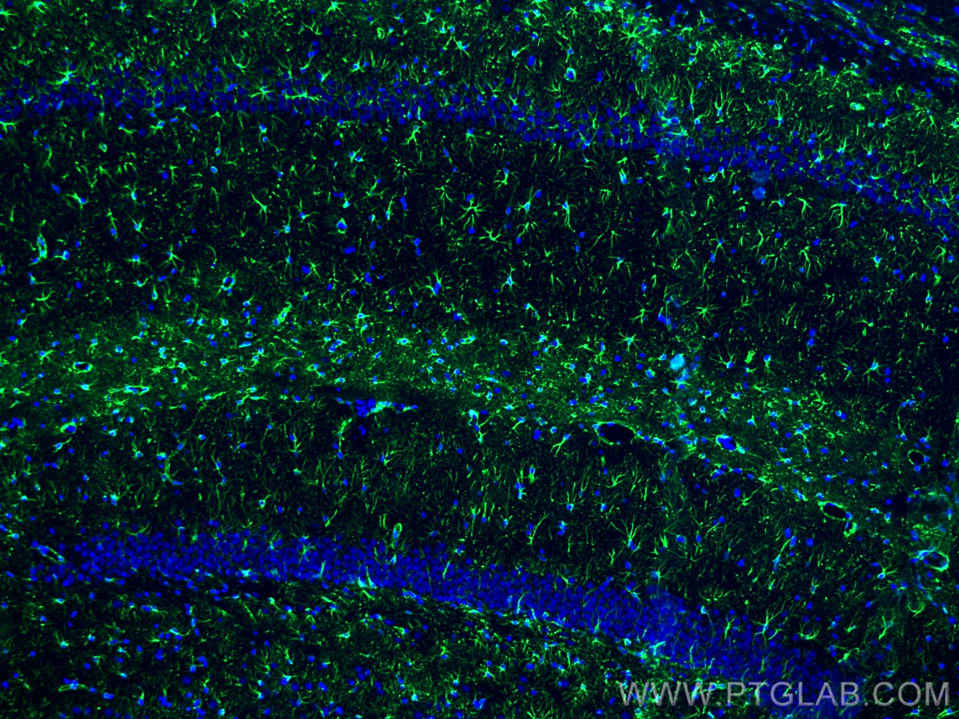 IF Staining of rat brain using 16825-1-AP