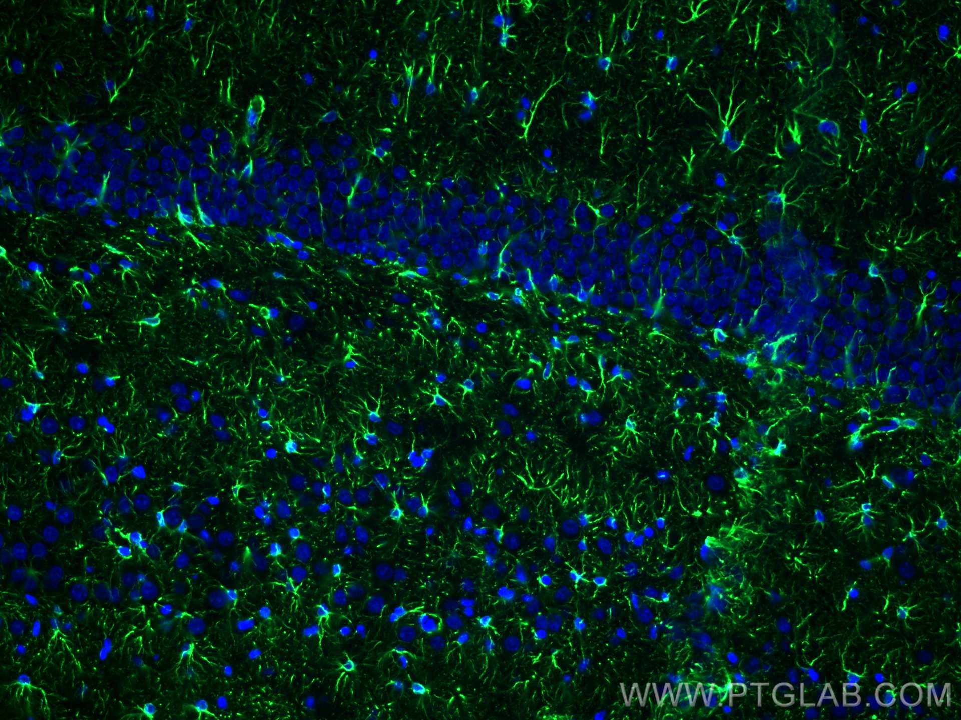Immunofluorescence (IF) / fluorescent staining of rat brain tissue using GFAP Polyclonal antibody (16825-1-AP)