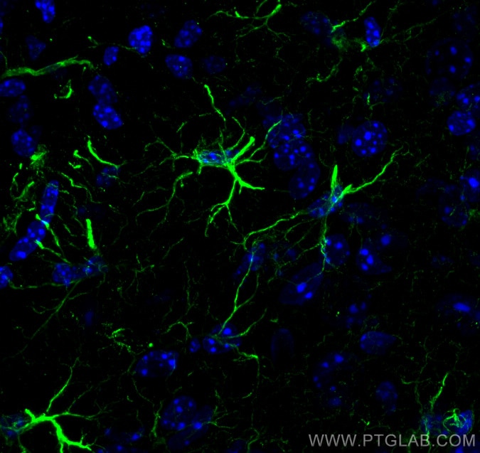 Immunofluorescence (IF) / fluorescent staining of mouse brain tissue using GFAP Polyclonal antibody (16825-1-AP)