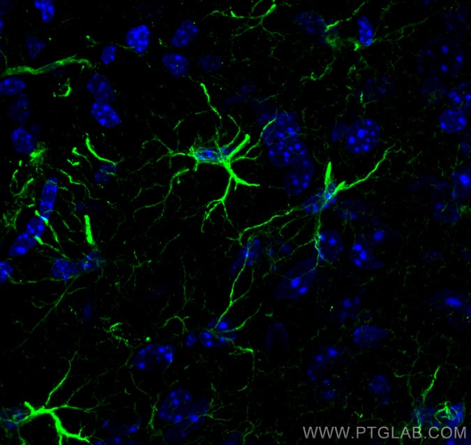 IF Staining of mouse brain using 16825-1-AP