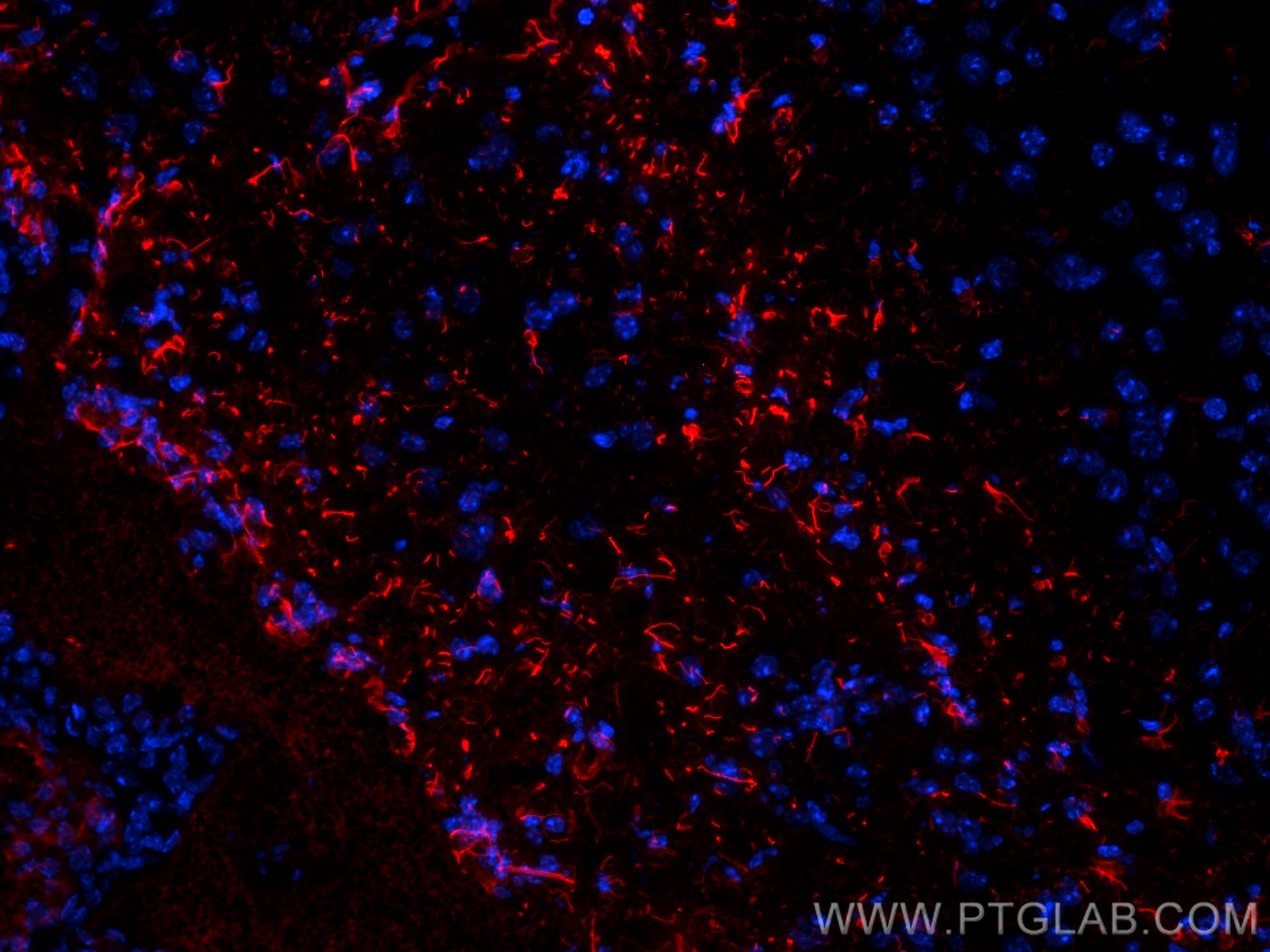 Immunofluorescence (IF) / fluorescent staining of mouse brain tissue using GFAP Polyclonal antibody (16825-1-AP)