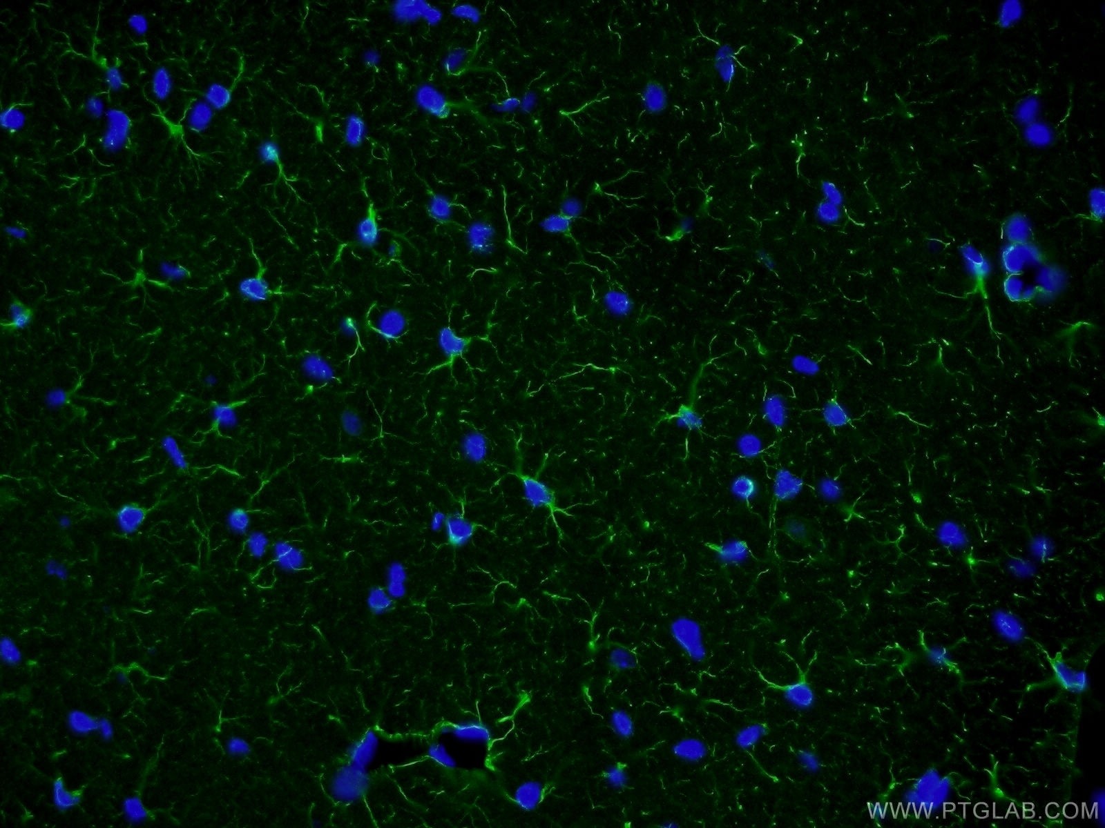 GFAP Polyclonal antibody