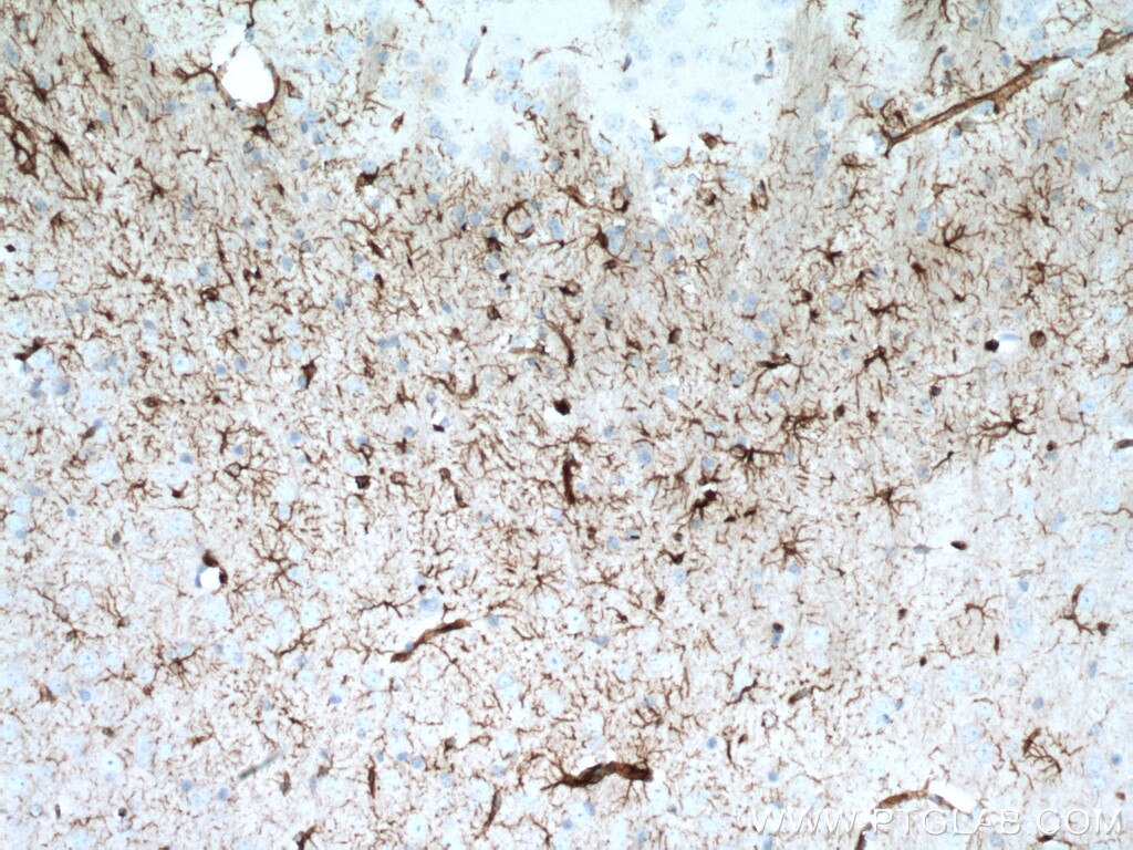 Immunohistochemistry (IHC) staining of mouse brain tissue using GFAP Polyclonal antibody (16825-1-AP)