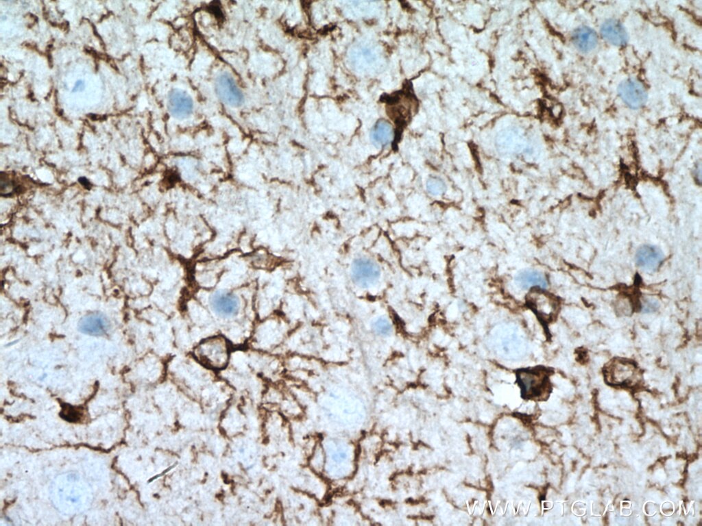 IHC staining of mouse brain using 16825-1-AP