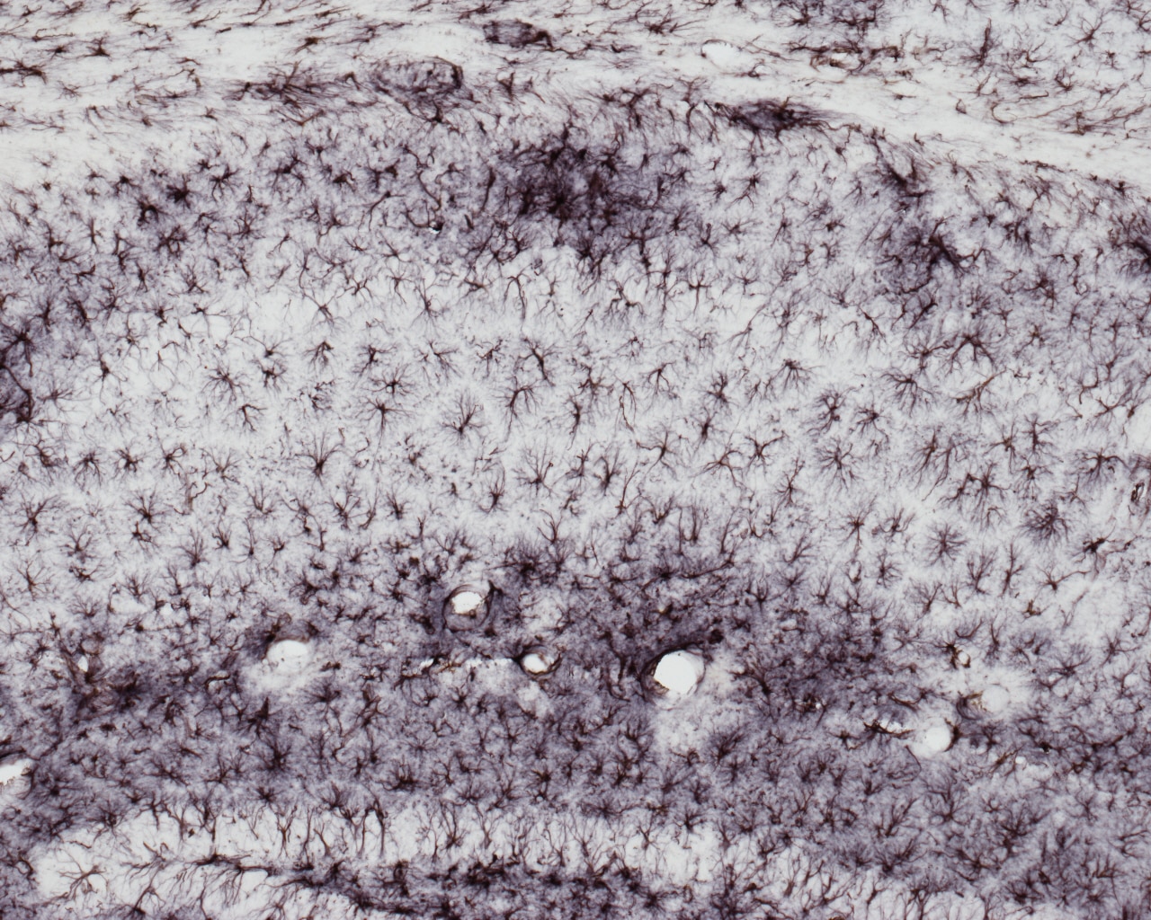 Immunohistochemistry (IHC) staining of Alzheimer mouse using GFAP Polyclonal antibody (16825-1-AP)