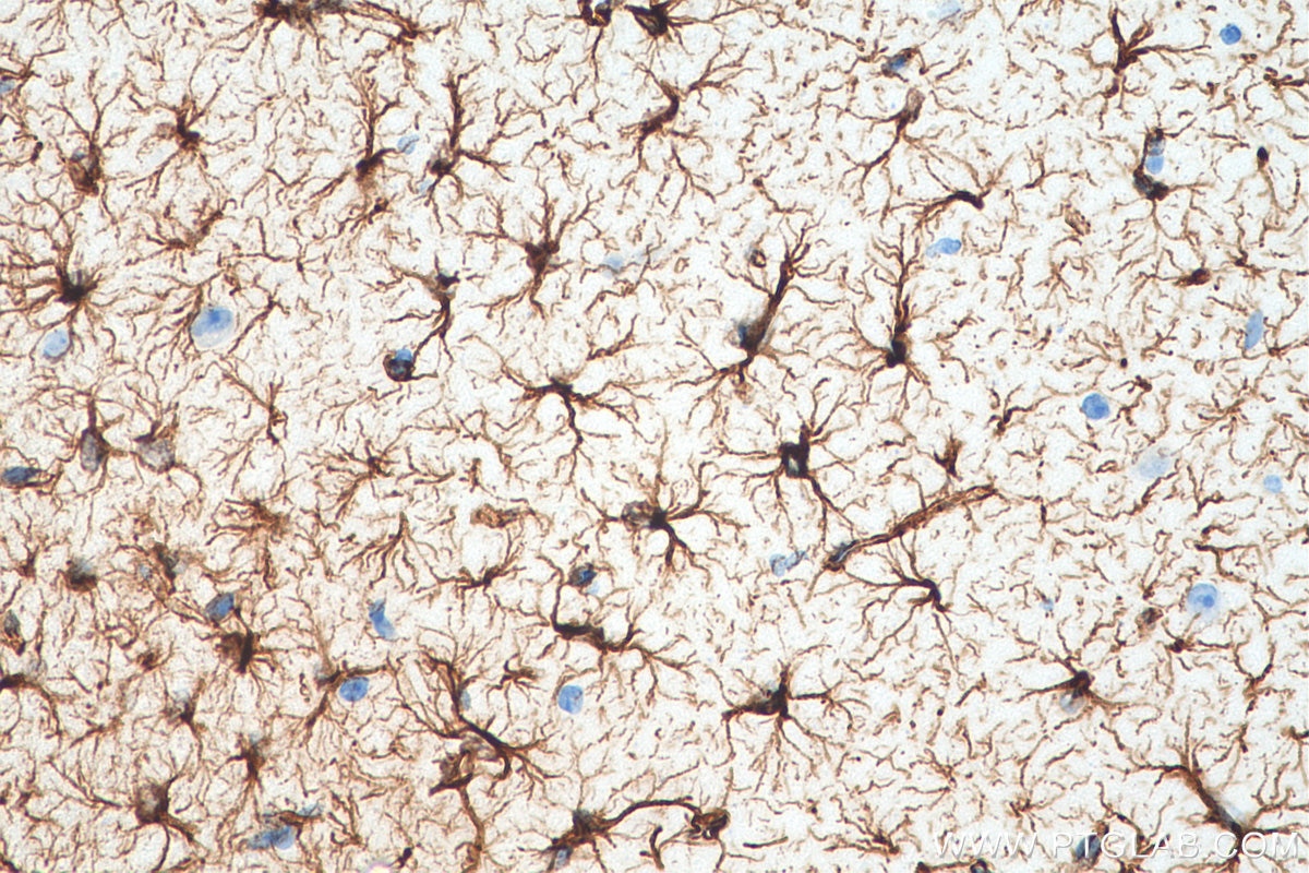 Immunohistochemistry (IHC) staining of mouse brain tissue using GFAP Polyclonal antibody (16825-1-AP)