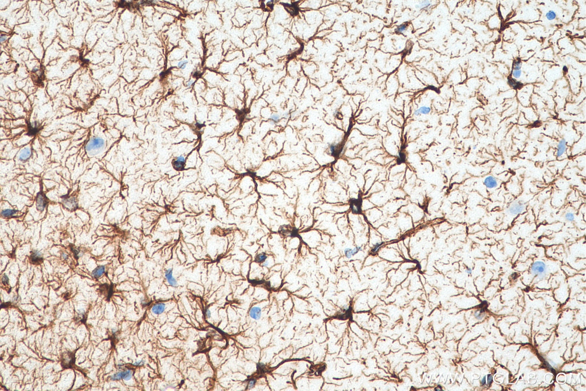 IHC staining of mouse brain using 16825-1-AP