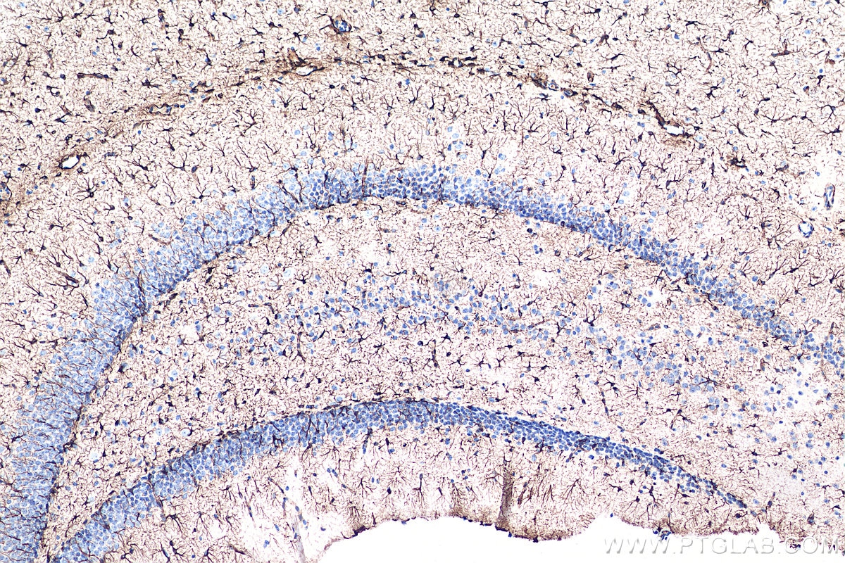 Immunohistochemistry (IHC) staining of mouse brain tissue using GFAP Polyclonal antibody (16825-1-AP)