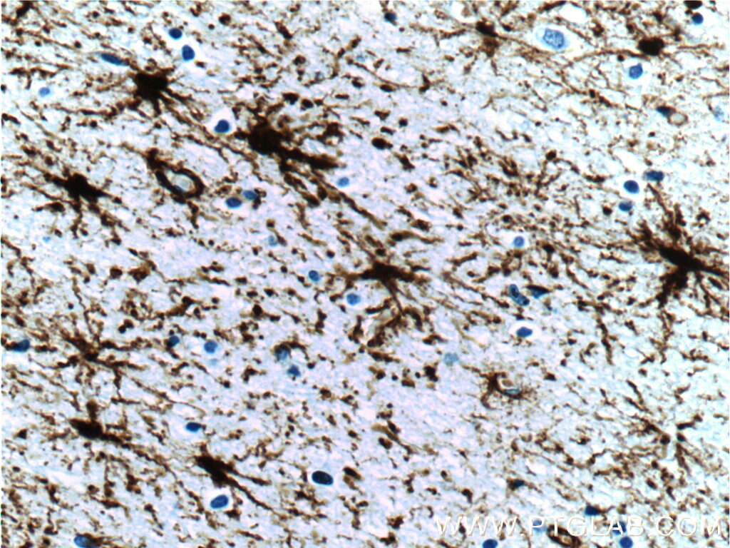 GFAP Polyclonal antibody