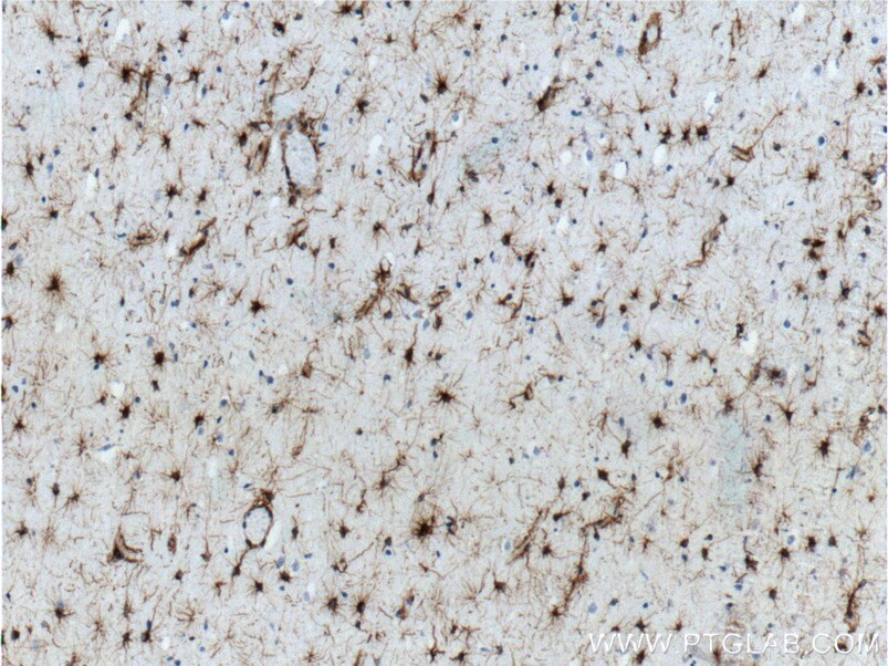 GFAP Polyclonal antibody