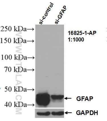 Western Blot (WB) analysis of U-251 cells using GFAP Polyclonal antibody (16825-1-AP)