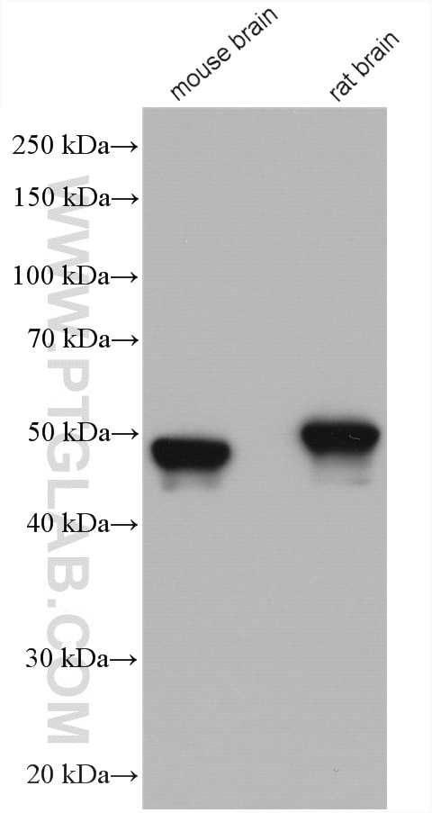 Western Blot (WB) analysis of various lysates using GFAP Polyclonal antibody (16825-1-AP)