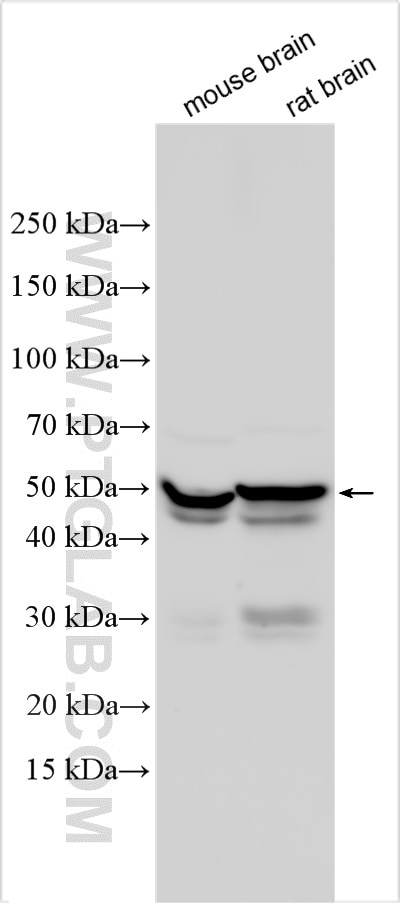 Western Blot (WB) analysis of various lysates using GFAP Polyclonal antibody (16825-1-AP)