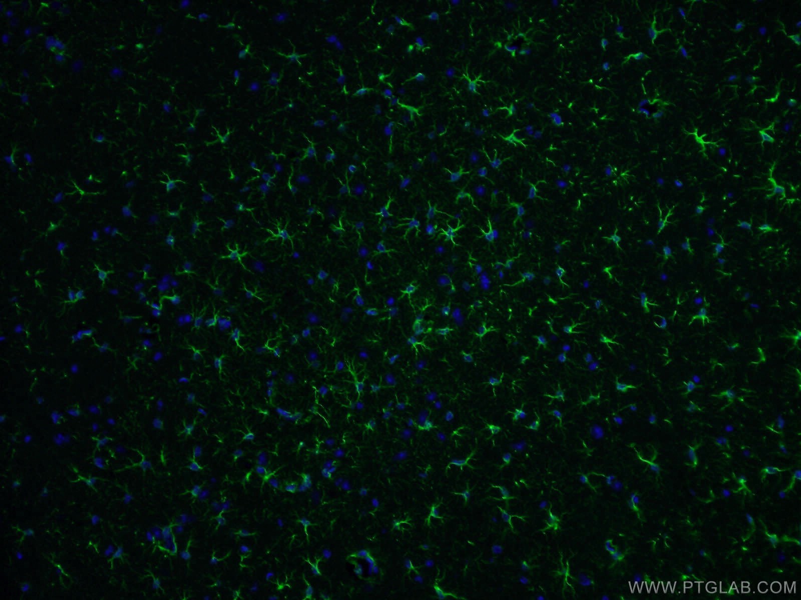 Immunofluorescence (IF) / fluorescent staining of mouse brain tissue using GFAP Polyclonal antibody (23935-1-AP)