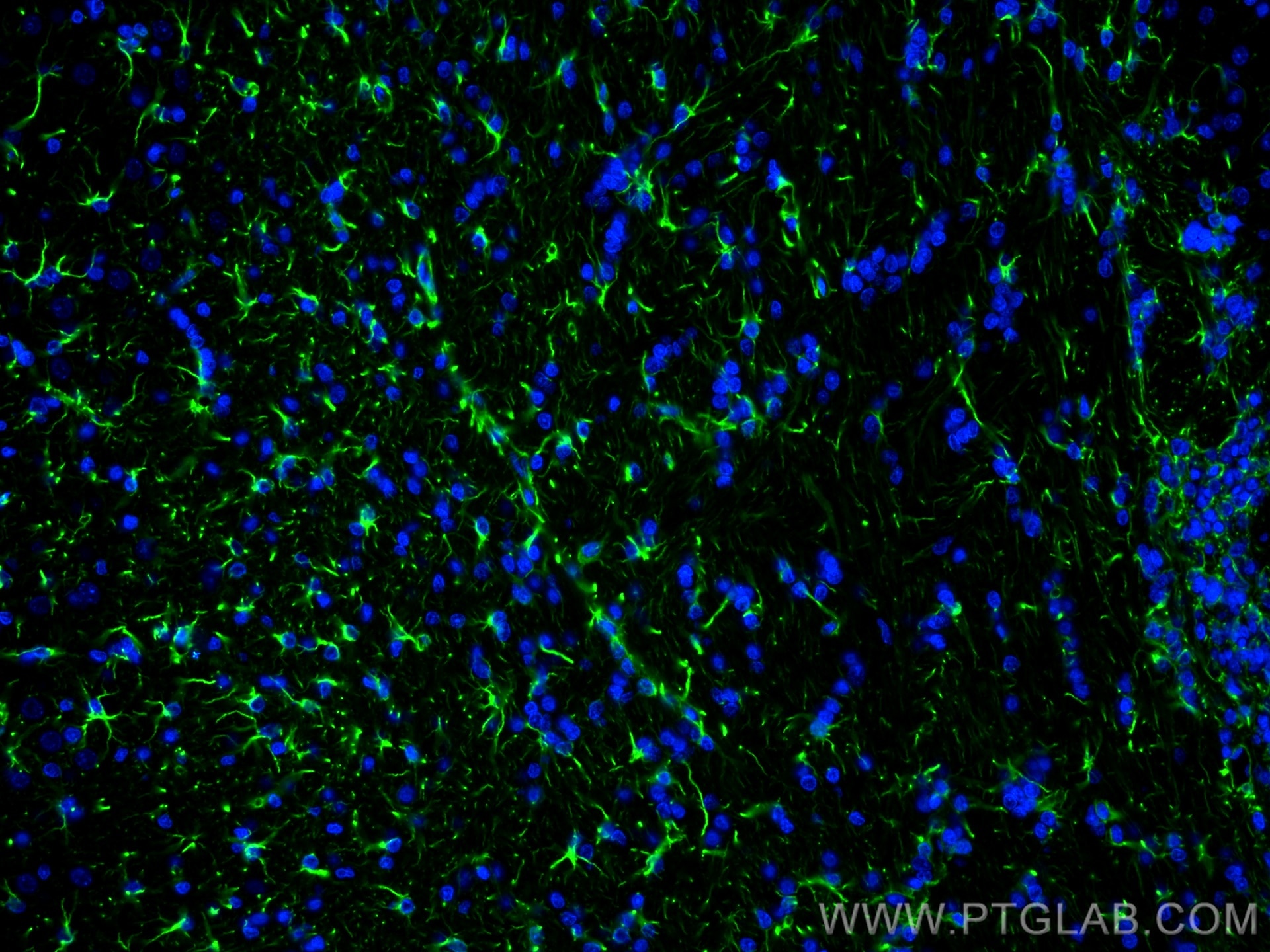 Immunofluorescence (IF) / fluorescent staining of rat brain tissue using GFAP Polyclonal antibody (23935-1-AP)
