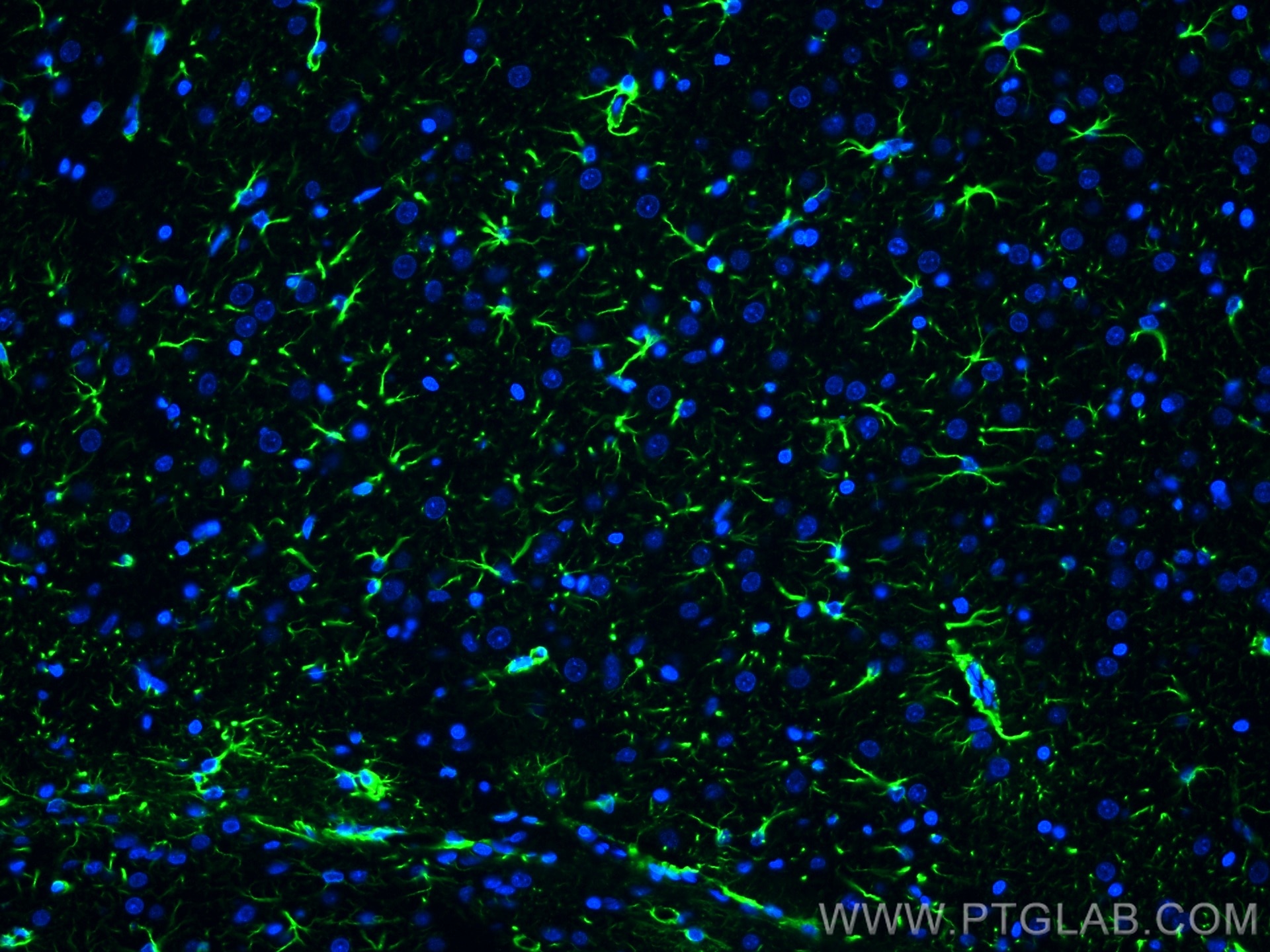 Immunofluorescence (IF) / fluorescent staining of rat brain tissue using GFAP Polyclonal antibody (23935-1-AP)