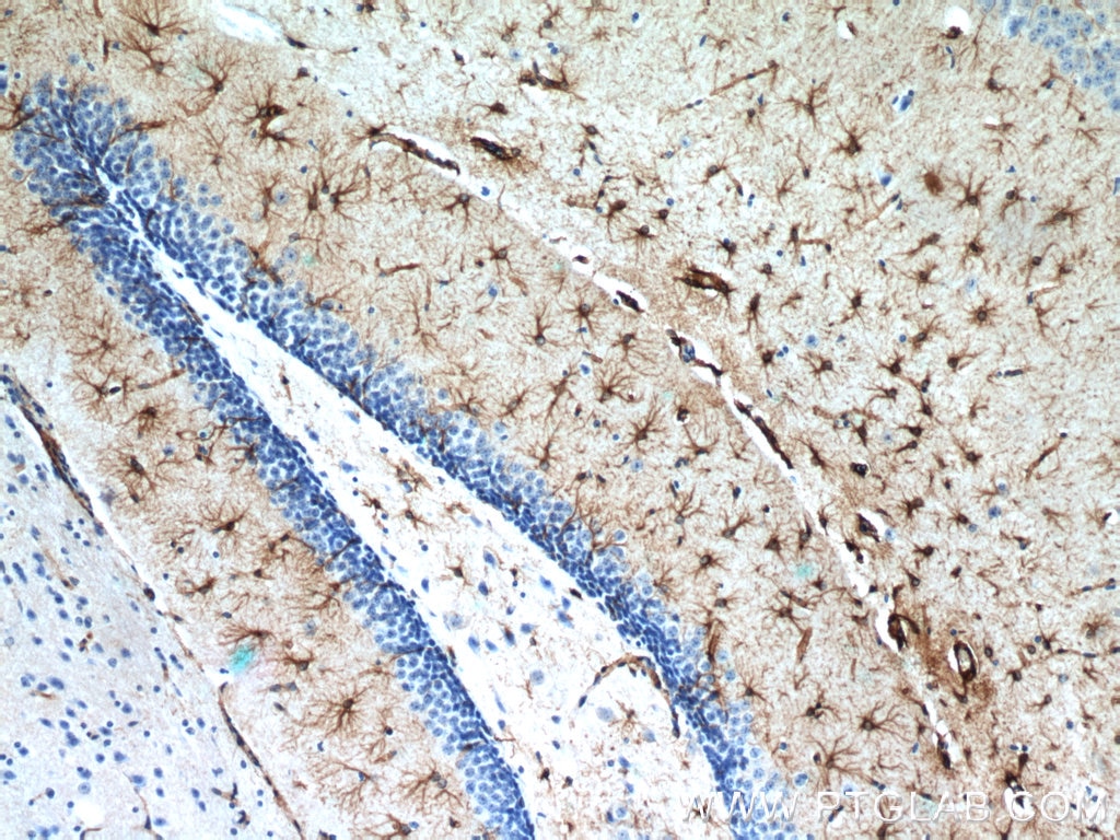 Immunohistochemistry (IHC) staining of mouse brain tissue using GFAP Polyclonal antibody (23935-1-AP)
