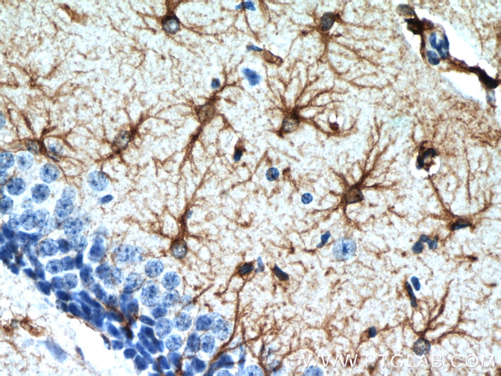 Immunohistochemistry (IHC) staining of mouse brain tissue using GFAP Polyclonal antibody (23935-1-AP)