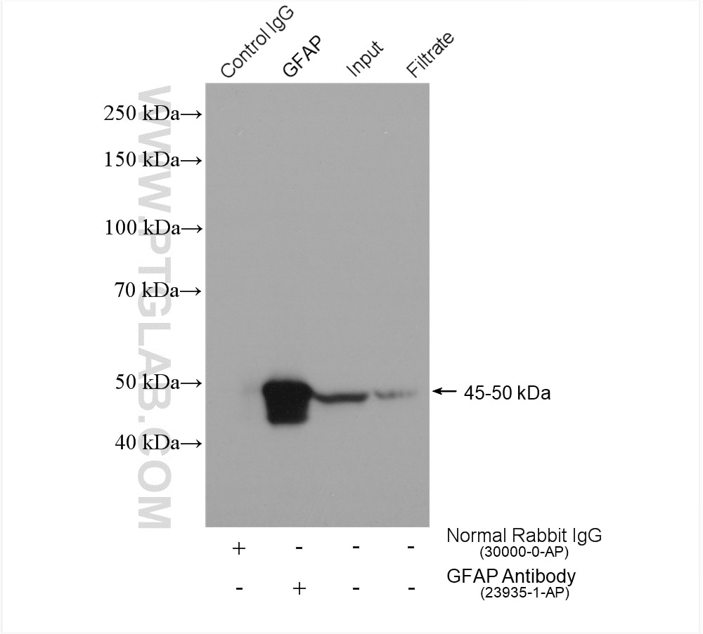 Immunoprecipitation (IP) experiment of mouse brain tissue using GFAP Polyclonal antibody (23935-1-AP)