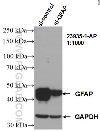 Western Blot (WB) analysis of U-251 cells using GFAP Polyclonal antibody (23935-1-AP)