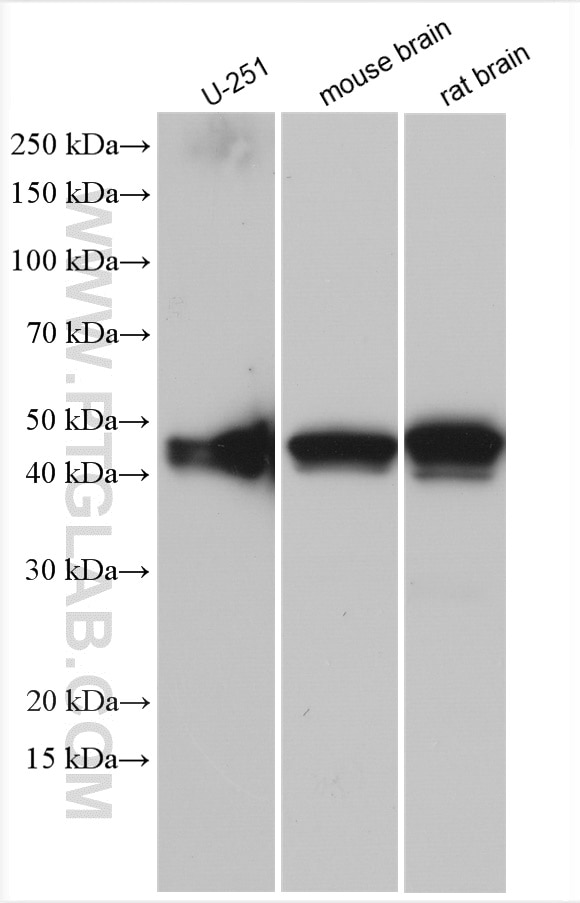 Western Blot (WB) analysis of various lysates using GFAP Polyclonal antibody (23935-1-AP)