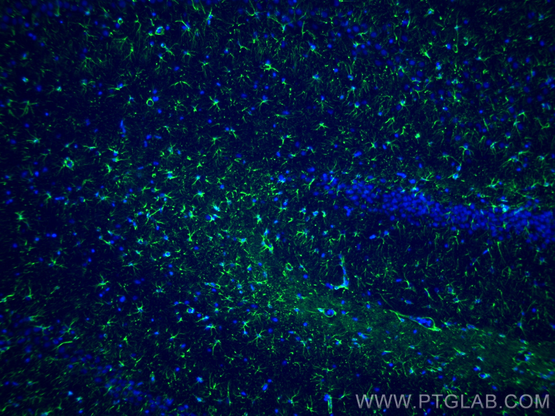 Immunofluorescence (IF) / fluorescent staining of rat brain tissue using GFAP Monoclonal antibody (60190-1-Ig)