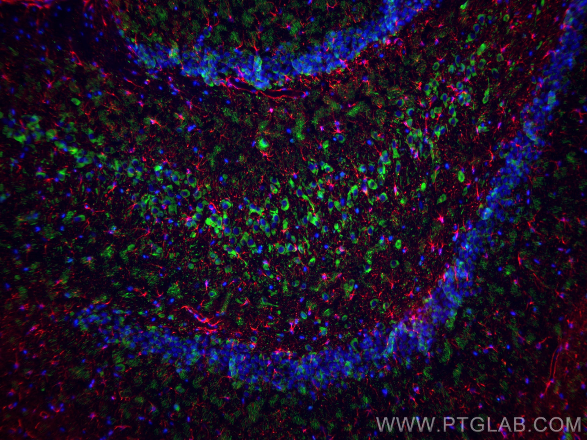 Immunofluorescence (IF) / fluorescent staining of rat brain tissue using GFAP Monoclonal antibody (60190-1-Ig)