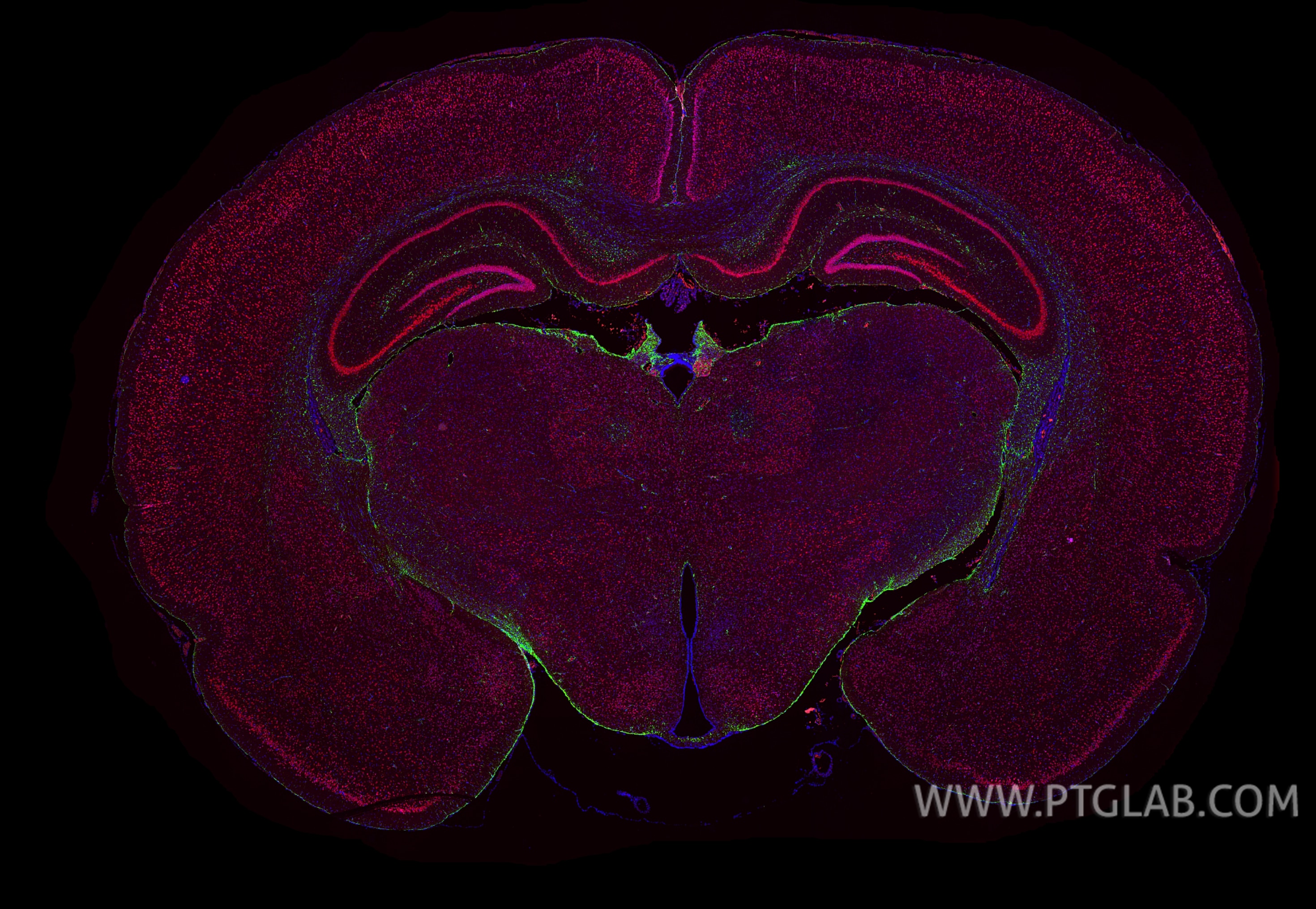 Immunofluorescence (IF) / fluorescent staining of rat brain tissue using GFAP Monoclonal antibody (60190-1-Ig)