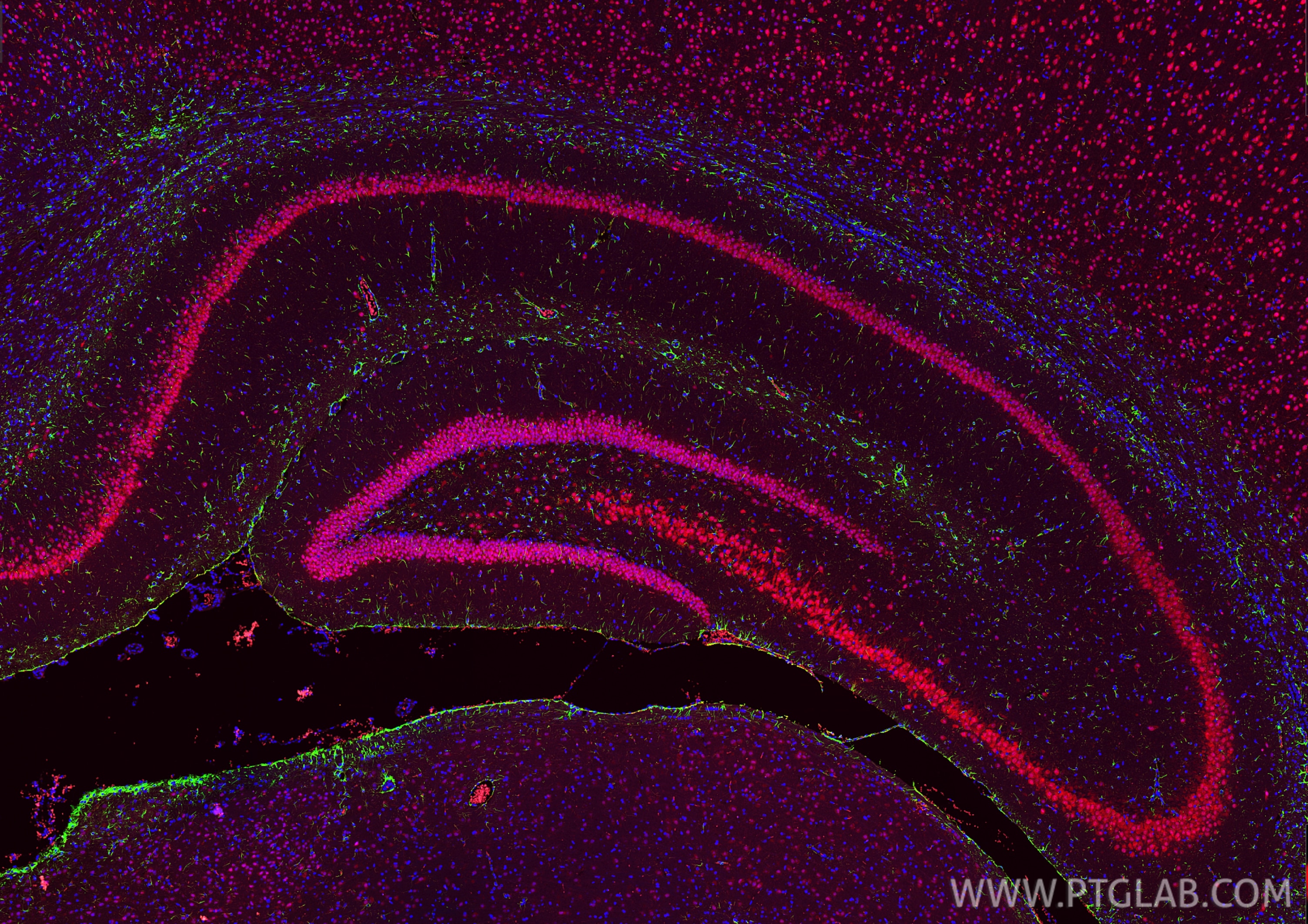 Immunofluorescence (IF) / fluorescent staining of rat brain tissue using GFAP Monoclonal antibody (60190-1-Ig)