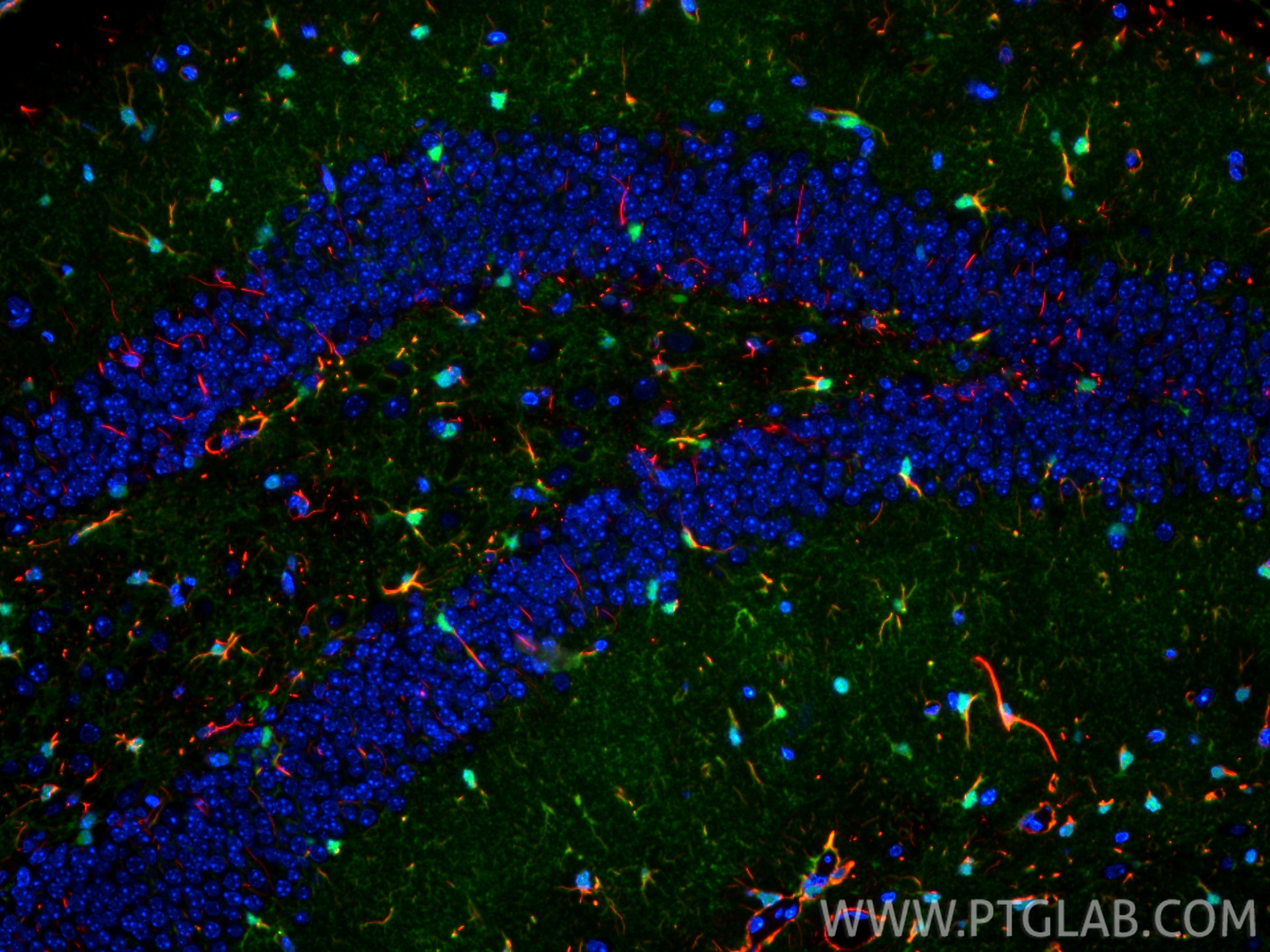 Immunofluorescent analysis of (4% PFA) fixed paraffin-embedded mouse brain tissue using GFAP antibody (60190-1-Ig, Clone: 4B2E10 ) at dilution of 1:400 and CoraLite®594-Conjugated Goat Anti-Mouse IgG(H+L) (SA00013-3), S100B antibody (82271-8-RR, Clone: 1E2, green). Heat mediated antigen retrieval with Tris-EDTA buffer (pH 9.0). Immunofluorescence (IF) / fluorescent staining of mouse brain tissue using GFAP Monoclonal antibody (60190-1-Ig)