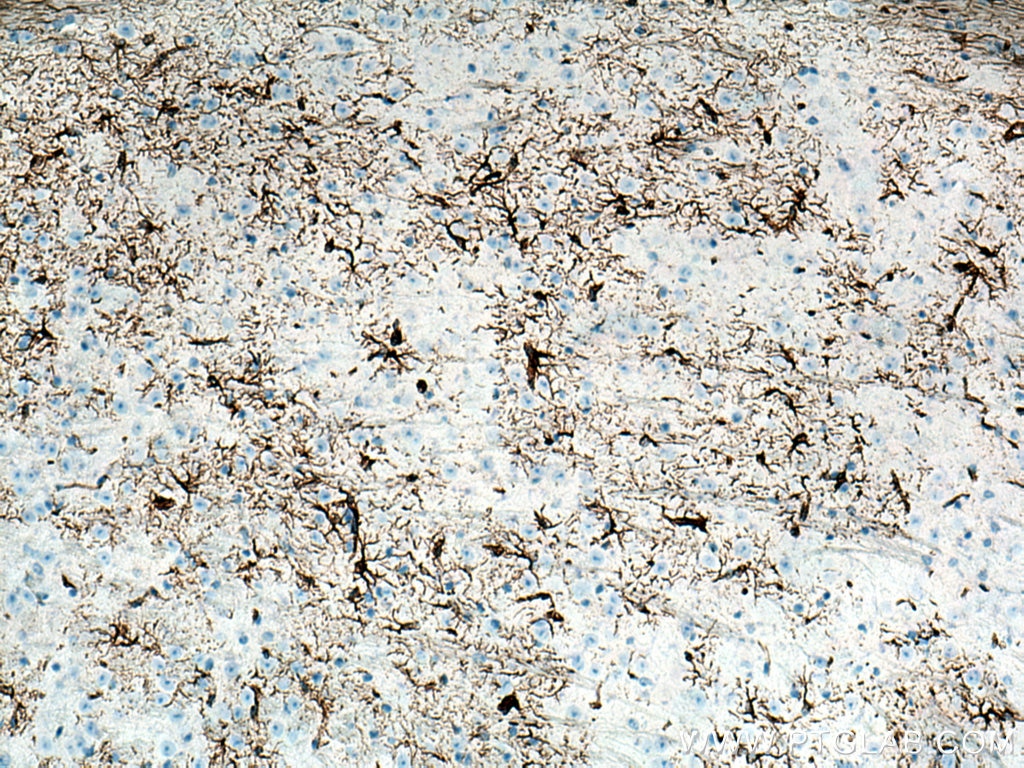 Immunohistochemistry (IHC) staining of mouse brain tissue using GFAP Monoclonal antibody (60190-1-Ig)