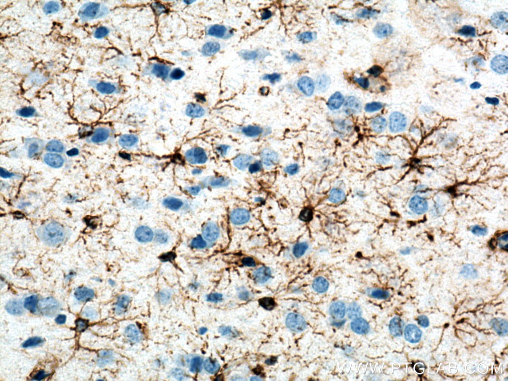 Immunohistochemistry (IHC) staining of rat brain tissue using GFAP Monoclonal antibody (60190-1-Ig)