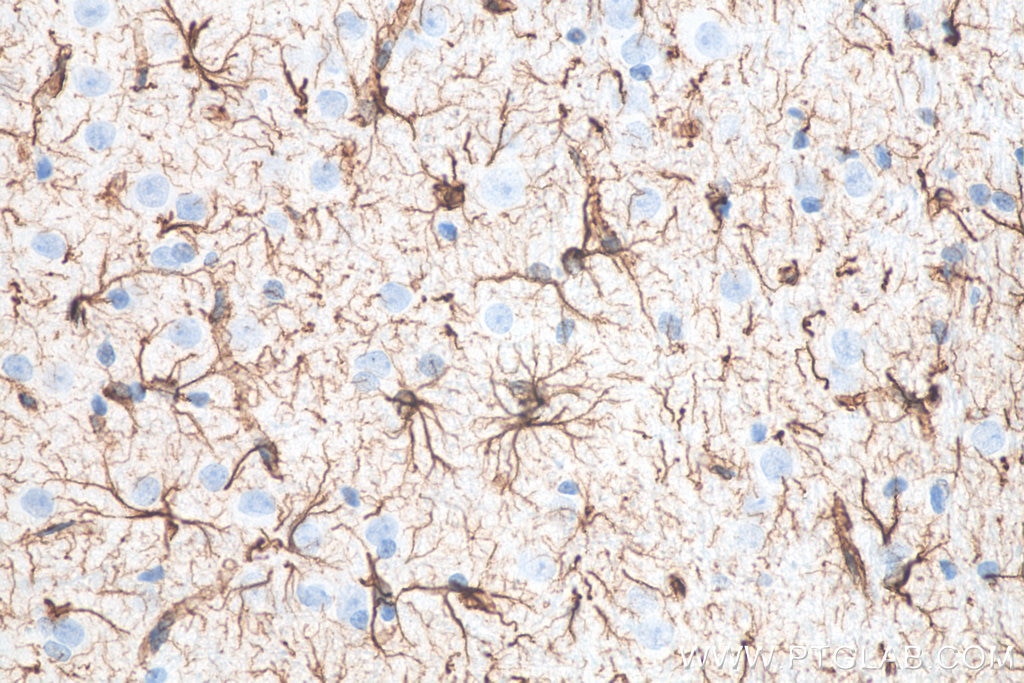 IHC staining of rat brain using 60190-1-Ig Immunohistochemistry (IHC) staining of rat brain tissue using GFAP Monoclonal antibody (60190-1-Ig)