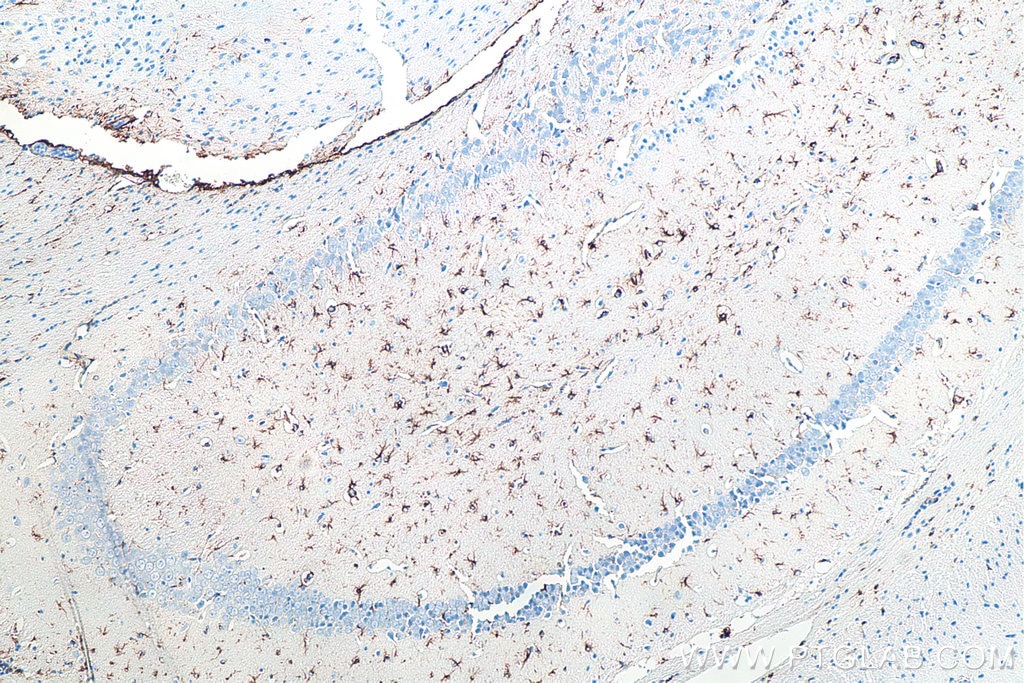 IHC staining of mouse brain using 60190-1-Ig Immunohistochemistry (IHC) staining of mouse brain tissue using GFAP Monoclonal antibody (60190-1-Ig)