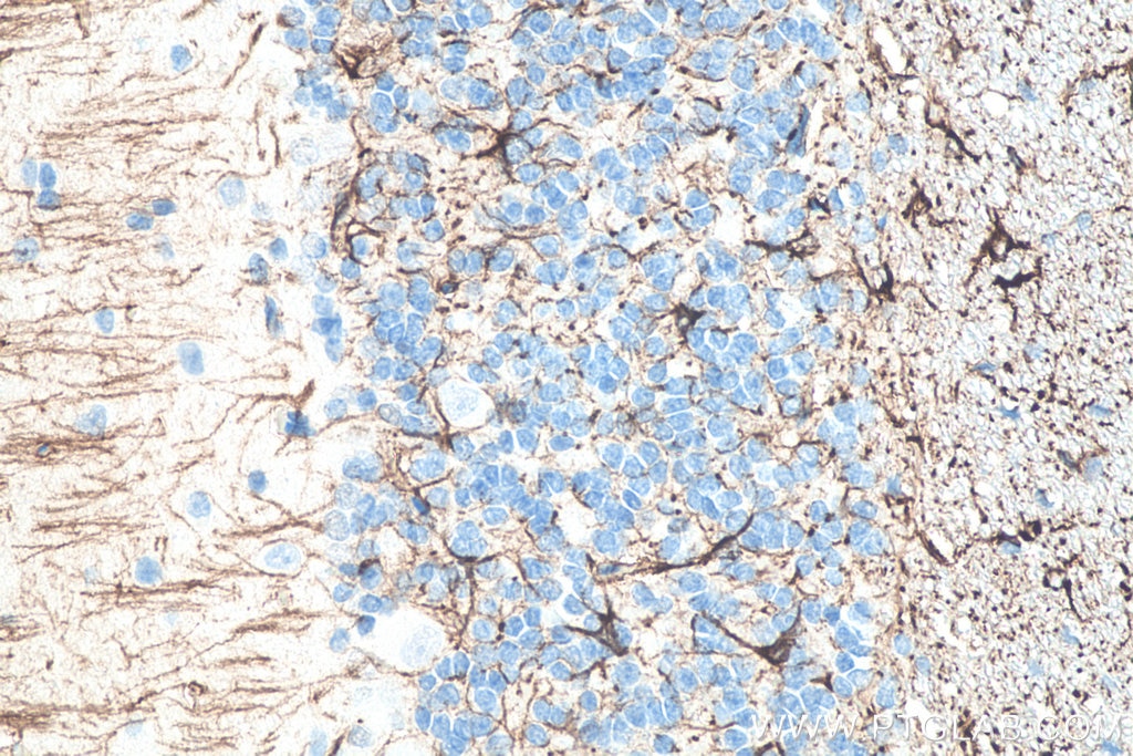 IHC staining of rat cerebellum using 60190-1-Ig Immunohistochemistry (IHC) staining of rat cerebellum tissue using GFAP Monoclonal antibody (60190-1-Ig)