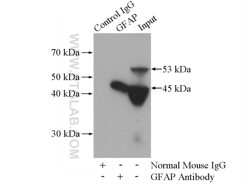 Immunoprecipitation (IP) experiment of mouse brain tissue using GFAP Monoclonal antibody (60190-1-Ig)